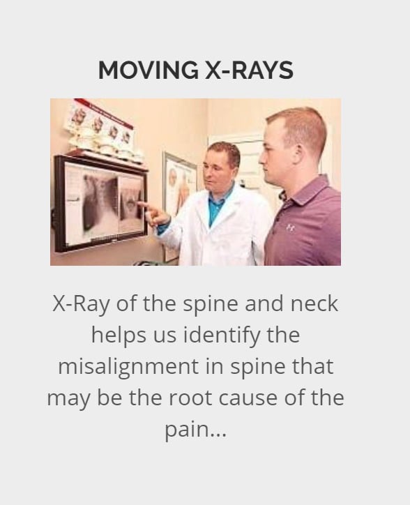 Moving X-Rays